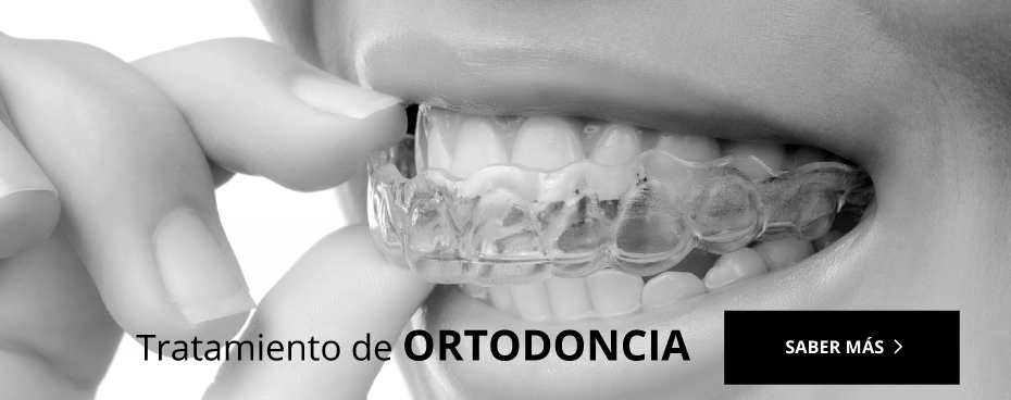 ortodoncia mejorada del campo